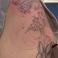 The Ultimate Guide to Choosing the Perfect Tattoo Removal Machine