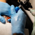 The Ultimate Guide to At-Home Tattoo Removal Machines