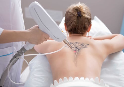 The Risks and Complications of Using a Tattoo Removal Machine on Previously Treated Tattoos