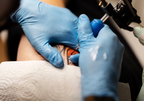 The Ultimate Guide to At-Home Tattoo Removal Machines